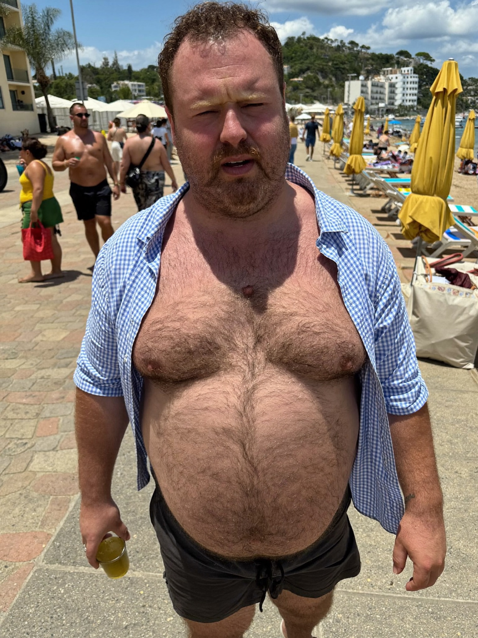 Illustrative photo pair, man in his forties — before treatment
